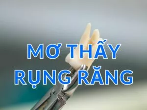 giải mã giấc mơ thấy rụng răng